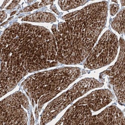 Invitrogen PPCS Polyclonal Antibody 100 &mu;L | Buy Online | Invitrogen&trade; | Fisher Scientific