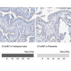 Invitrogen C1orf87 Polyclonal Antibody 100 &mu;L | Buy Online | Invitrogen&trade; | Fisher Scientific