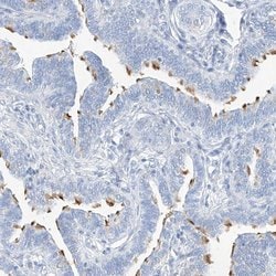Invitrogen C1orf87 Polyclonal Antibody 100 &mu;L | Buy Online | Invitrogen&trade; | Fisher Scientific