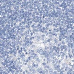 Invitrogen C1orf87 Polyclonal Antibody 100 &mu;L | Buy Online | Invitrogen&trade; | Fisher Scientific
