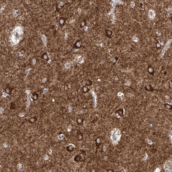 Invitrogen CPNE5 Polyclonal Antibody 100 &mu;L; Unconjugated:Antibodies,