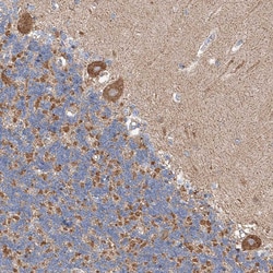 Invitrogen CPNE5 Polyclonal Antibody 100 &mu;L; Unconjugated:Antibodies,