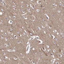 Invitrogen CPNE5 Polyclonal Antibody 100 &mu;L; Unconjugated:Antibodies,