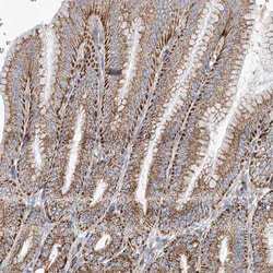 Invitrogen CPNE5 Polyclonal Antibody 100 &mu;L; Unconjugated:Antibodies,