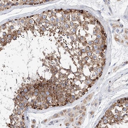 Invitrogen CPNE5 Polyclonal Antibody 100 &mu;L; Unconjugated:Antibodies,