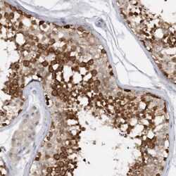 Invitrogen DDX43 Polyclonal Antibody 100 &mu;L; Unconjugated:Antibodies,