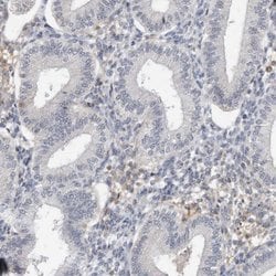 Invitrogen DDX43 Polyclonal Antibody 100 &mu;L; Unconjugated:Antibodies,