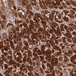 PREP Polyclonal Antibody:Antibodies, Polyclonal