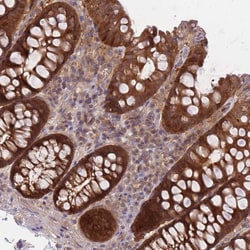 Invitrogen PREP Polyclonal Antibody 100 &mu;L; Unconjugated:Antibodies,
