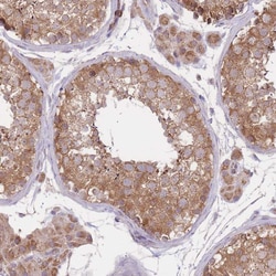 PREP Polyclonal Antibody:Antibodies, Polyclonal