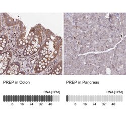 PREP Polyclonal Antibody:Antibodies, Polyclonal
