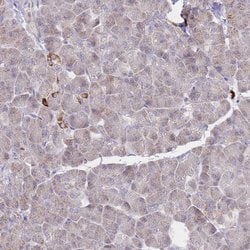 PREP Polyclonal Antibody:Antibodies, Polyclonal