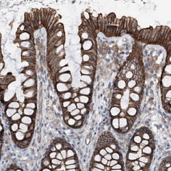 Invitrogen GPR142 Polyclonal Antibody 100 &mu;L | Buy Online | Invitrogen&trade; | Fisher Scientific