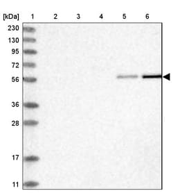Invitrogen RMND1 Polyclonal Antibody 100 &mu;L | Buy Online | Invitrogen&trade; | Fisher Scientific