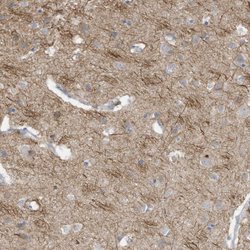 Invitrogen GTPBP2 Polyclonal Antibody 100 &mu;L; Unconjugated:Antibodies,