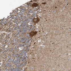Invitrogen GTPBP2 Polyclonal Antibody 100 &mu;L; Unconjugated:Antibodies,