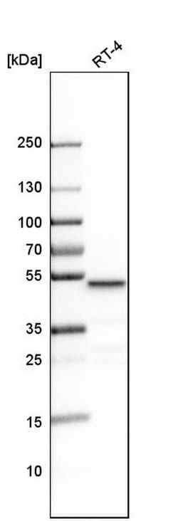 Invitrogen LCOR Polyclonal Antibody 100 &mu;L; Unconjugated:Antibodies,