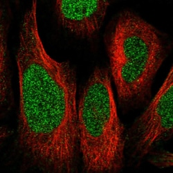 Invitrogen ZNF512 Polyclonal Antibody 100 &mu;L; Unconjugated:Antibodies,