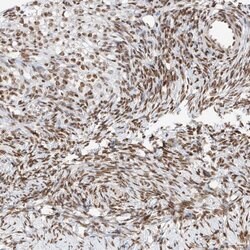 Invitrogen ZNF512 Polyclonal Antibody 100 &mu;L; Unconjugated:Antibodies,