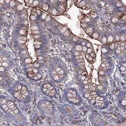 Invitrogen EphA8 Polyclonal Antibody 100 &mu;L; Unconjugated:Antibodies,