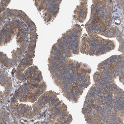 EXOC4 Polyclonal Antibody:Antibodies, Polyclonal