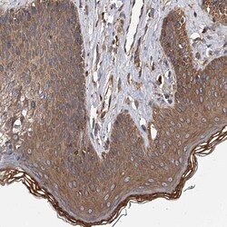 EXOC4 Polyclonal Antibody:Antibodies, Polyclonal