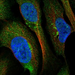 Invitrogen C1orf58 Polyclonal Antibody 100 &mu;L; Unconjugated:Antibodies,