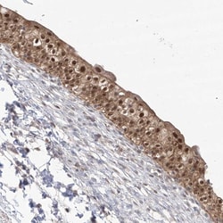 Invitrogen C1orf58 Polyclonal Antibody 100 &mu;L; Unconjugated:Antibodies,