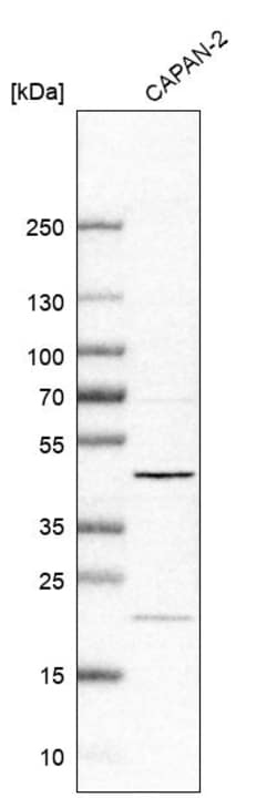 Invitrogen C1orf58 Polyclonal Antibody 100 &mu;L | Buy Online | Invitrogen&trade; | Fisher Scientific