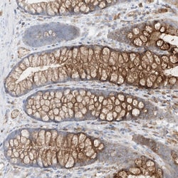 Invitrogen HLA-E Polyclonal Antibody 100 &mu;L; Unconjugated:Antibodies,
