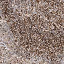 Invitrogen HLA-E Polyclonal Antibody 100 &mu;L; Unconjugated:Antibodies,