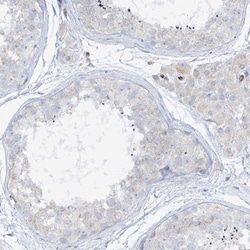 Invitrogen HLA-E Polyclonal Antibody 100 &mu;L; Unconjugated:Antibodies,