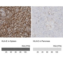 Invitrogen HLA-E Polyclonal Antibody 100 &mu;L; Unconjugated:Antibodies,