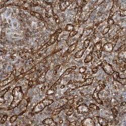 Invitrogen HLA-E Polyclonal Antibody 100 &mu;L; Unconjugated:Antibodies,
