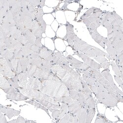 Invitrogen HRNR Polyclonal Antibody 100 &mu;L; Unconjugated:Antibodies,