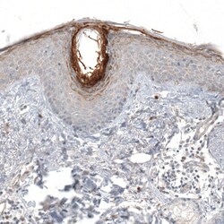 Invitrogen HRNR Polyclonal Antibody 100 &mu;L; Unconjugated:Antibodies,