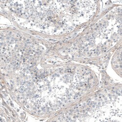 Invitrogen HRNR Polyclonal Antibody 100 &mu;L; Unconjugated:Antibodies,