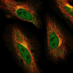 Invitrogen ABCG1 Polyclonal Antibody 100 &mu;L; Unconjugated:Antibodies,