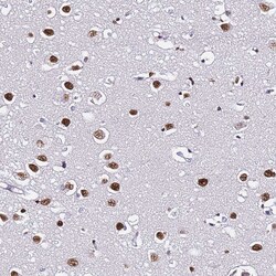 Invitrogen POLR1A Polyclonal Antibody 100 &mu;L; Unconjugated:Antibodies,