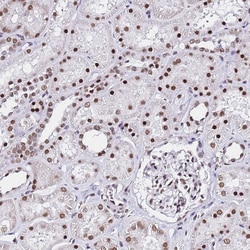 Invitrogen POLR1A Polyclonal Antibody 100 &mu;L; Unconjugated:Antibodies,