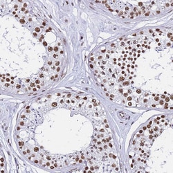 Invitrogen POLR1A Polyclonal Antibody 100 &mu;L; Unconjugated:Antibodies,