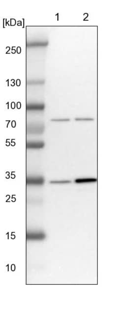 Invitrogen V-ATPase D Polyclonal Antibody 100 &mu;L; Unconjugated:Antibodies,
