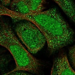 Invitrogen RP9 Polyclonal Antibody 100 &mu;L; Unconjugated:Antibodies,