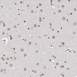 Invitrogen RP9 Polyclonal Antibody 100 &mu;L; Unconjugated:Antibodies,