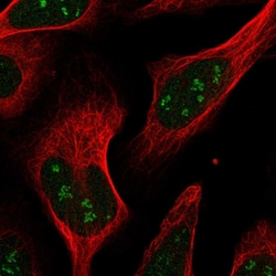 Invitrogen RPAIN Polyclonal Antibody 100 &mu;L; Unconjugated:Antibodies,