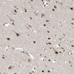 Invitrogen RPAIN Polyclonal Antibody 100 &mu;L; Unconjugated:Antibodies,
