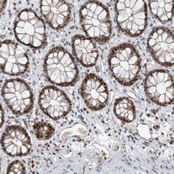 Invitrogen RPAIN Polyclonal Antibody 100 &mu;L; Unconjugated:Antibodies,