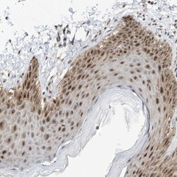 Invitrogen RPAIN Polyclonal Antibody 100 &mu;L; Unconjugated:Antibodies,