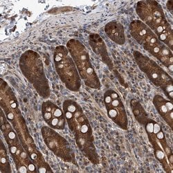 Invitrogen GMDS Polyclonal Antibody 100 &mu;L; Unconjugated:Antibodies,