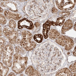 Invitrogen MTX2 Polyclonal Antibody 100 &mu;L; Unconjugated:Antibodies,